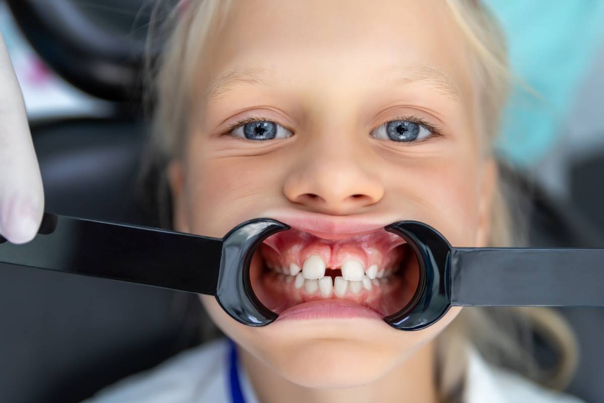 Dentizione bambini: come avviene?  Ortondozia Infantile - Centri  Dentistici Primo